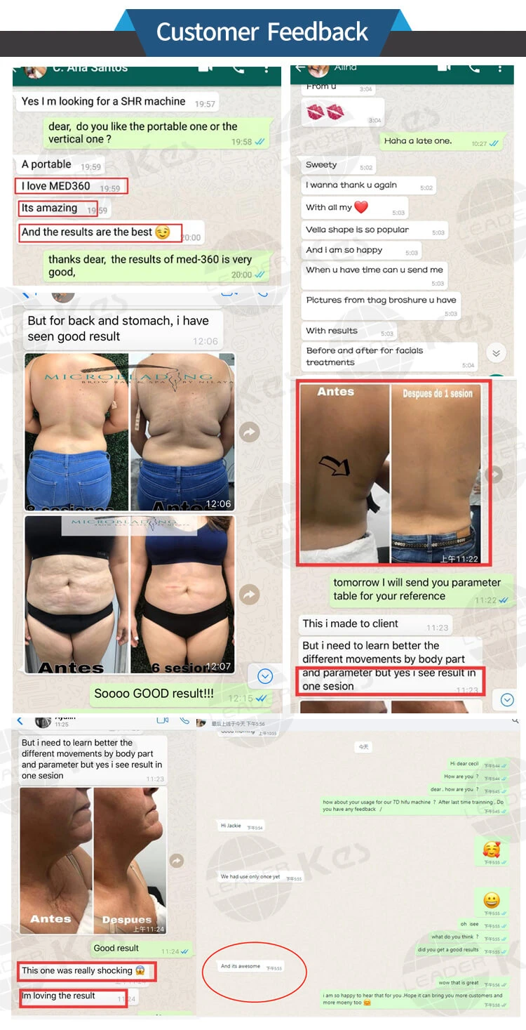 velashape customer feedback 7