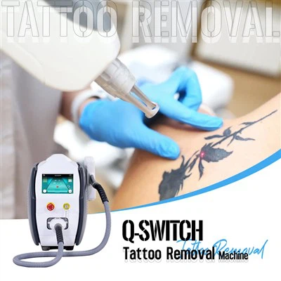 ND YAG Laser tatoveringsfjernelse